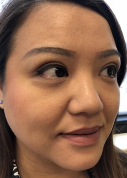 Asian double eye lid Asian double eye lid