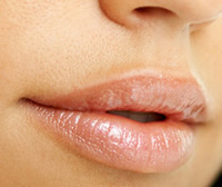 Læbeforbedring | fedtoverførsel | St. Paul MN | Træbury mn