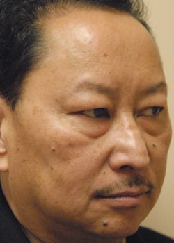 Before Image: Asian Double Eyelid and Lower Eyelid - right-front-oblique