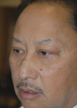 After Image: Asian Double Eyelid and Lower Eyelid - left-front-oblique