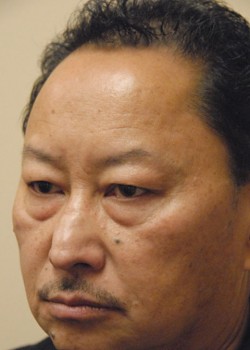 Before Image: Asian Double Eyelid and Lower Eyelid - left-front-oblique