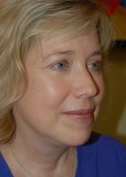 After Image: Face Lift, Upper and Lower Eyelid - right-front-oblique
