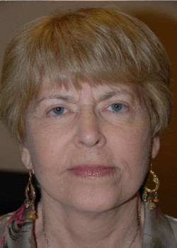 After Image: Face Lift - front