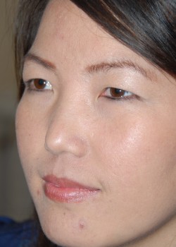 Before Image: Asian Double Eyelid - left-front-oblique