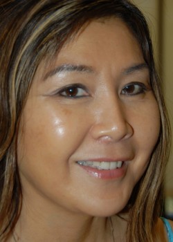 After Image: Face Lift - right-front-oblique