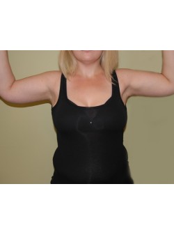 After Image: Arm Lift - front