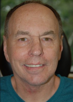 After Image: Face Lift and Neck Lift - front