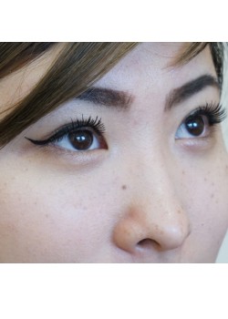 After Image: Asian Double Eyelid - right-front-oblique
