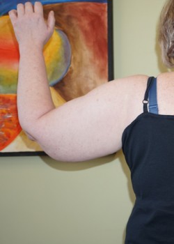Before Image: Arm Lift - back